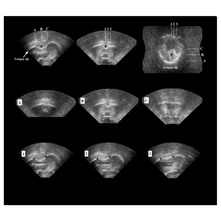 Acquiring and visualizing 3D/4D ultrasound recordings of tongue motion